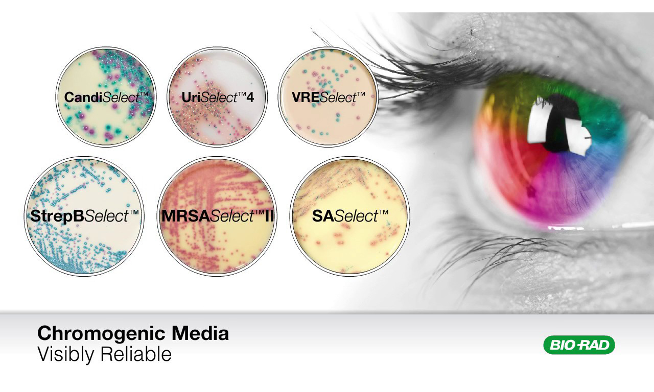 Công nghệ RAPID'Chromogenic để phát hiện, phân lập, đếm các loại vi sinh vật gây bệnh trong thực phẩm và môi trường